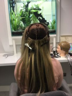 Hair-replacement-Hair-Loss-Treatments-Essex-3