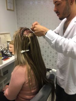 Hair-replacement-Hair-Loss-Treatments-Essex-4