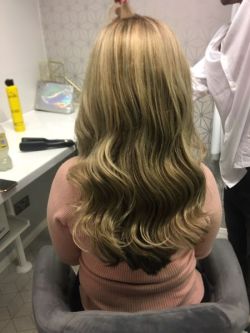Hair-replacement-Hair-Loss-Treatments-Essex-5